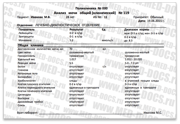 Результат общего клинического анализа мочи