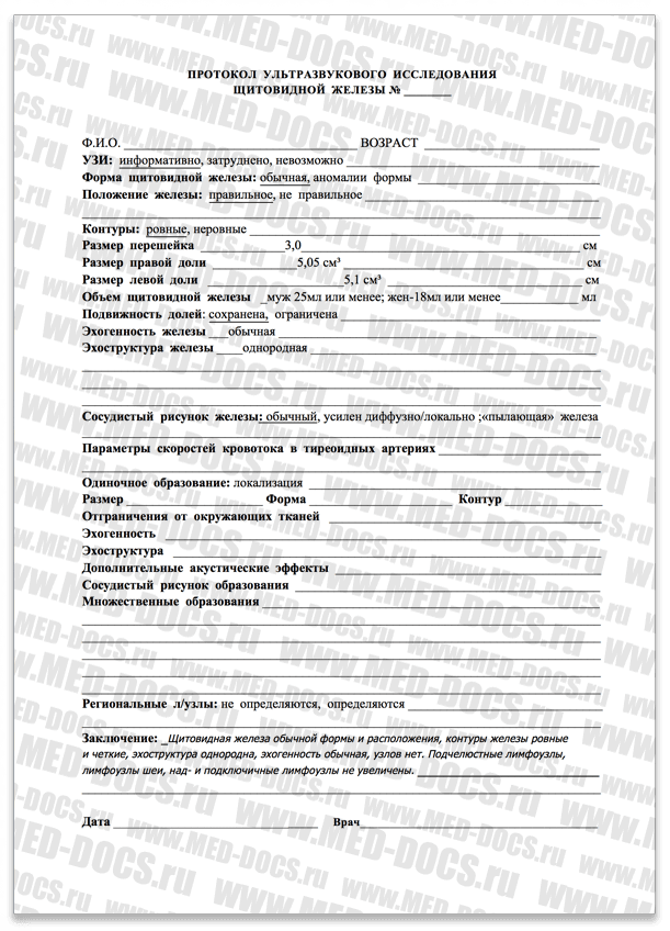 Результат анализа щитовидной железы (УЗИ)